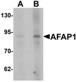 Anti-AFAP1 Antibody