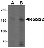 Anti-RGS22 Antibody