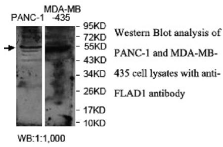 Anti-FLAD1 Antibody