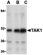 Anti-TAK1 Antibody