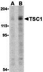 Anti-TSC1 Antibody