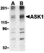 Anti-ASK1 Antibody