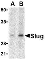 Anti-Slug Antibody