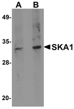Anti-SKA1 Antibody