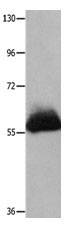 Anti-HPSE Antibody