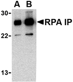 Anti-RPA Interacting Protein Antibody