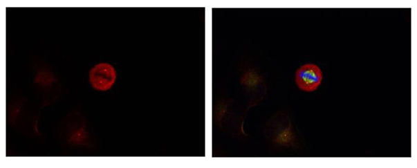 Anti-p44 / 42 MAP Kinase (Phospho-Tyr204) Antibody