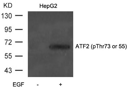 Anti-ATF2 (Phospho-Thr73 or 55) Antibody