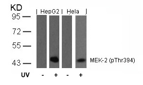 Anti-MEK2 (Phospho-Thr394) Antibody