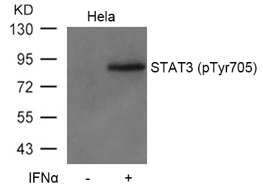 Anti-STAT3 (Phospho-Tyr705) Antibody