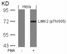 Anti-LIMK2 (Phospho-Thr505) Antibody