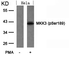 Anti-MKK3 (Phospho-Ser189) Antibody