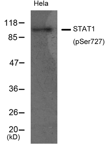 Anti-STAT1 (Phospho-Ser727) Antibody