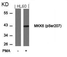 Anti-MKK6 (Phospho-Ser207) Antibody