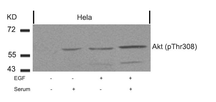 Anti-Akt (Phospho-Thr308) Antibody