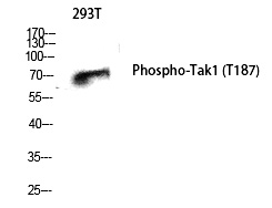 Anti-Tak1 (Phospho-Thr187) Antibody