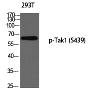 Anti-Tak1 (Phospho-Ser439) Antibody