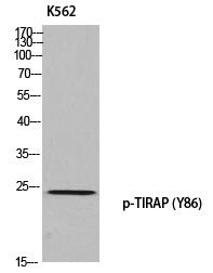 Anti-TIRAP (Phospho-Tyr86) Antibody