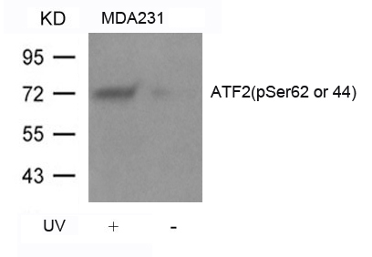 Anti-ATF2 (Phospho-Ser62 or 44) Antibody