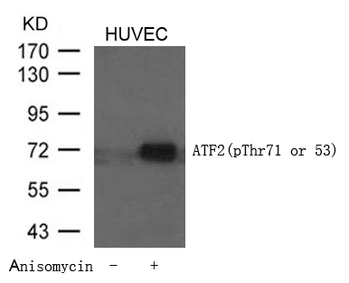 Anti-ATF2 (Phospho-Thr71 or 53) Antibody