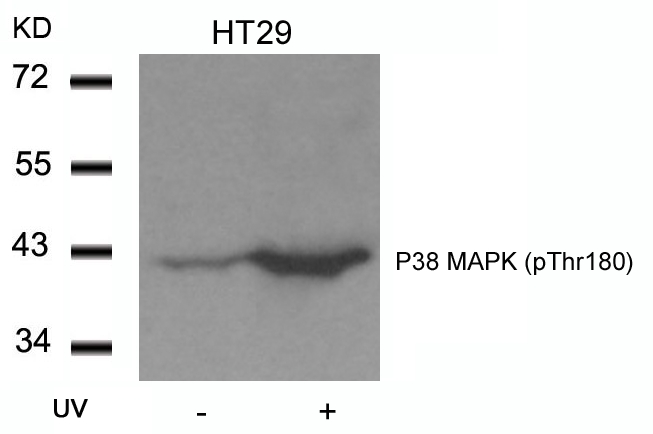 Anti-P38 MAPK (Phospho-Thr180) Antibody