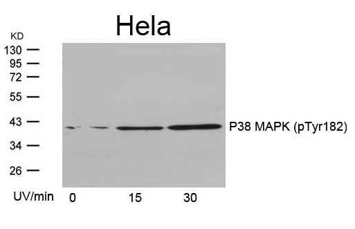 Anti-P38 MAPK (Phospho-Tyr182) Antibody