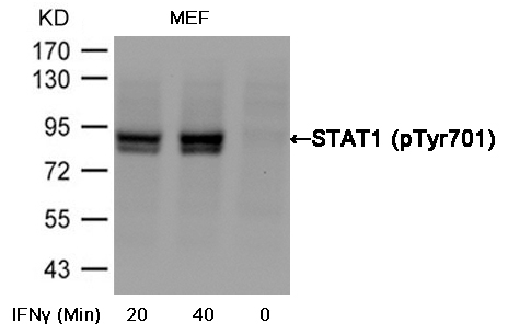 Anti-STAT1 (Phospho-Tyr701) Antibody