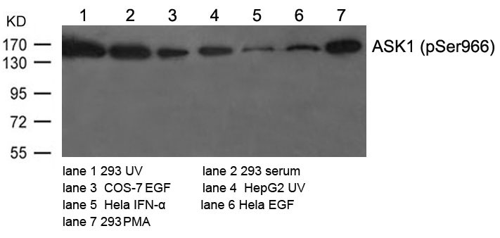 Anti-ASK1 (Phospho-Ser966) Antibody