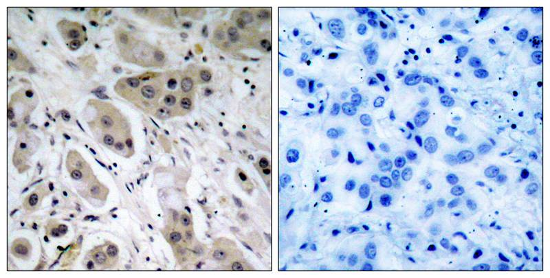 Anti-Akt (Phospho-Ser473) Antibody