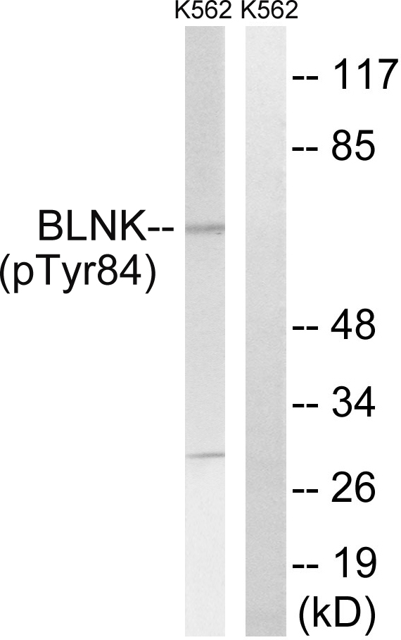 Anti-BLNK (Phospho-Tyr84) Antibody