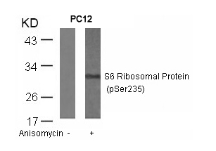 Anti-S6 Ribosomal Protein (Phospho-Ser235) Antibody