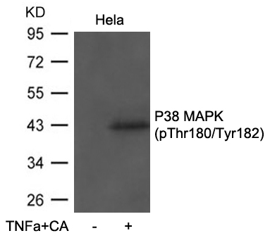 Anti-P38 MAPK (Phospho-Thr180 / Tyr182) Antibody