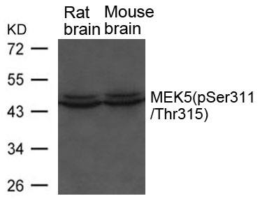 Anti-MEK5 (phospho-Ser311 / Thr315) Antibody