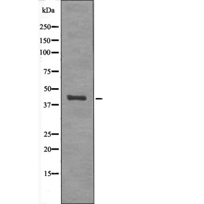 Anti-p38-gamma / delta (Phospho-Tyr185 / 182) Antibody