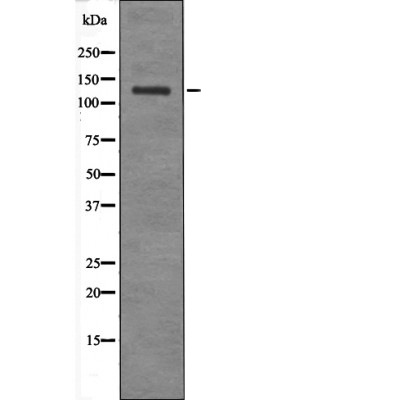 Anti-JAK2 / 3 (Phospho-Tyr966 / 939) Antibody