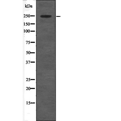 Anti-CACNA1C (Phospho-Ser1927) Antibody