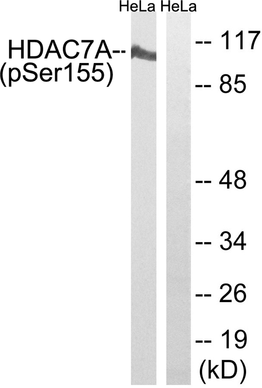 Anti-HDAC7A (Phospho-Ser155) Antibody