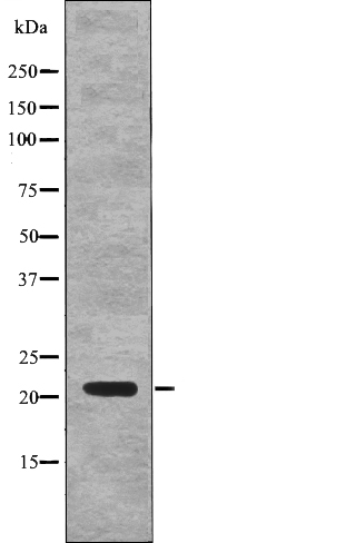 Anti-p21Cip1 (Phospho-Thr57) Antibody