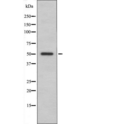 Anti-ILK-1 (Phospho-Ser343) Antibody