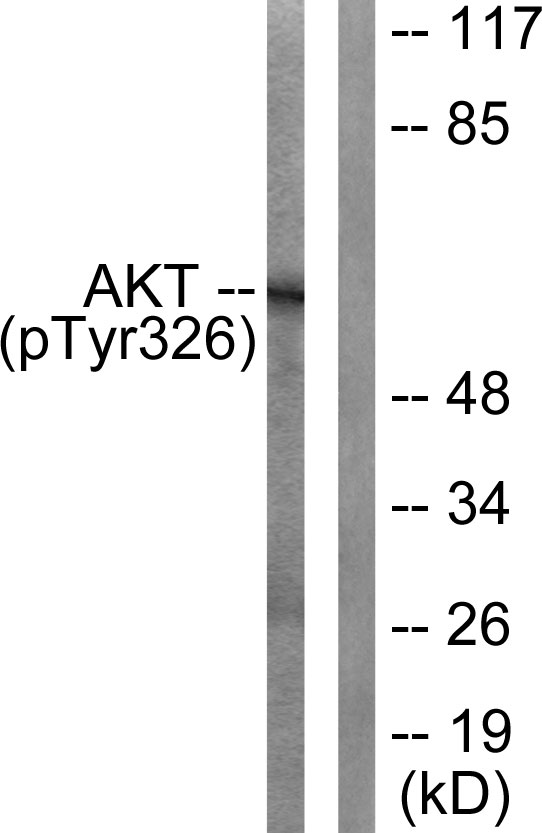 Anti-Akt (Phospho-Tyr326) Antibody