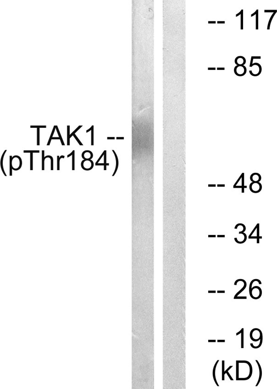 Anti-TAK1 (Phospho-Thr184) Antibody