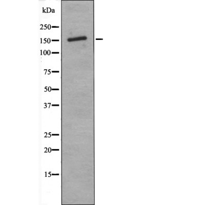 Anti-ASK1 (Phospho-Thr838) Antibody