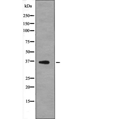 Anti-MCL1 (Phospho-Thr163) Antibody