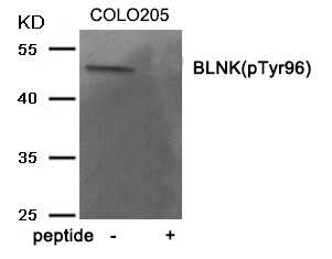 Anti-BLNK (Phospho-Tyr96) Antibody