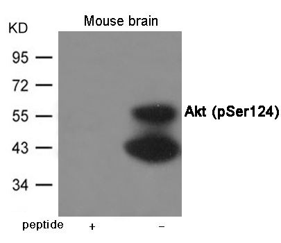 Anti-Akt (Phospho-Ser124) Antibody