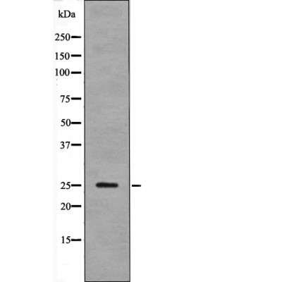 Anti-LAB (Phospho-Tyr136) Antibody