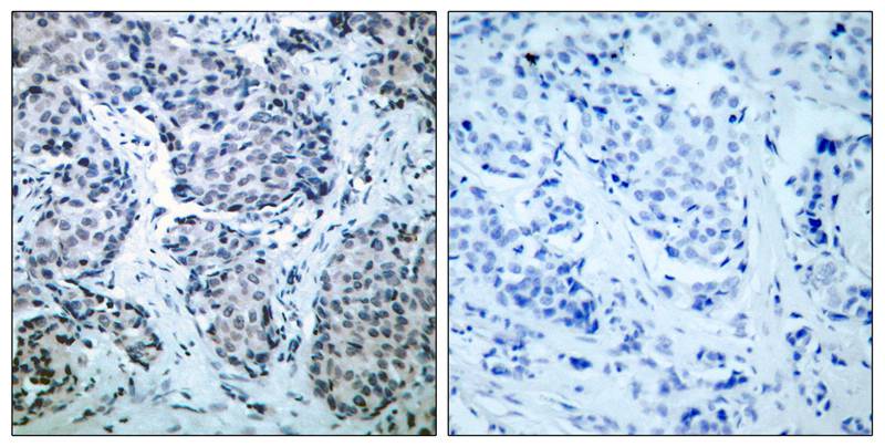 Anti-SEK1 / MKK4 (Phospho-Thr261) Antibody