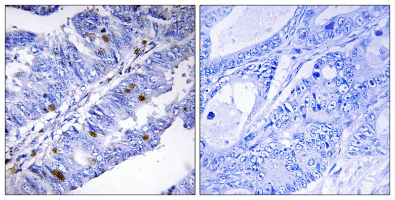 Anti-Nuclear Receptor NR4A1 (Phospho-Ser351) Antibody