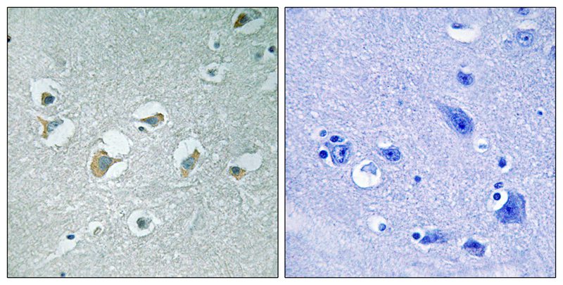 Anti-MLK1 / 2 (Phospho-Thr312 / 266) Antibody