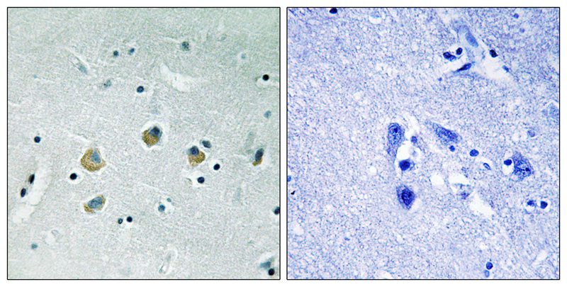 Anti-MAP3K8 (Phospho-Ser400) Antibody